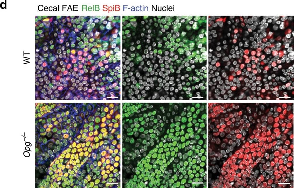 Detection of Mouse Spi-B by Immunocytochemistry/Immunofluorescence