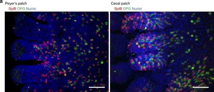 Detection of Mouse Spi-B by Immunocytochemistry/Immunofluorescence