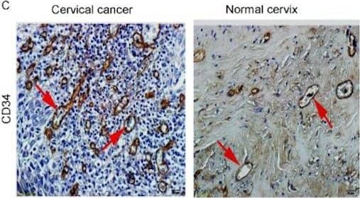 Detection of Human CD34 by Immunohistochemistry