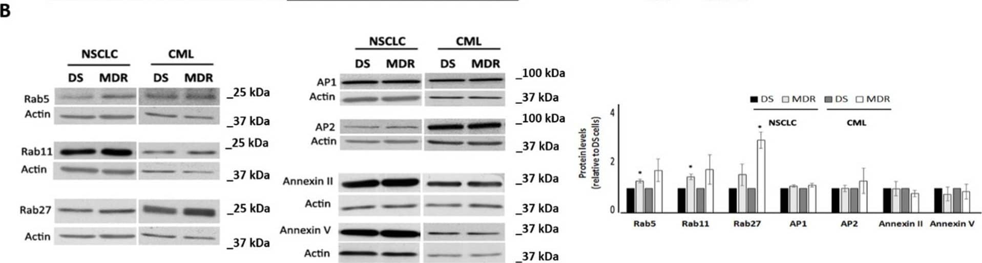 Detection of Rab27a by Western Blot