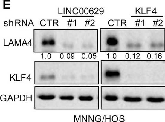 Detection of Laminin alpha 4 by Western Blot
