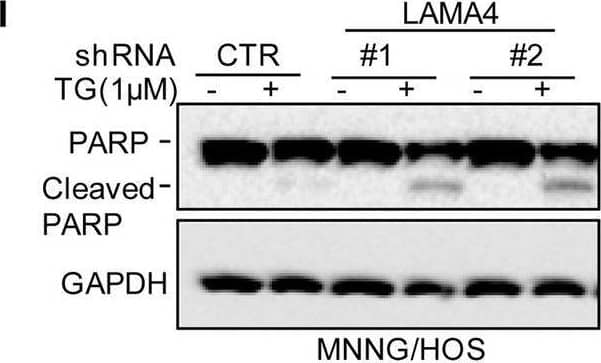 Detection of Laminin alpha 4 by Western Blot