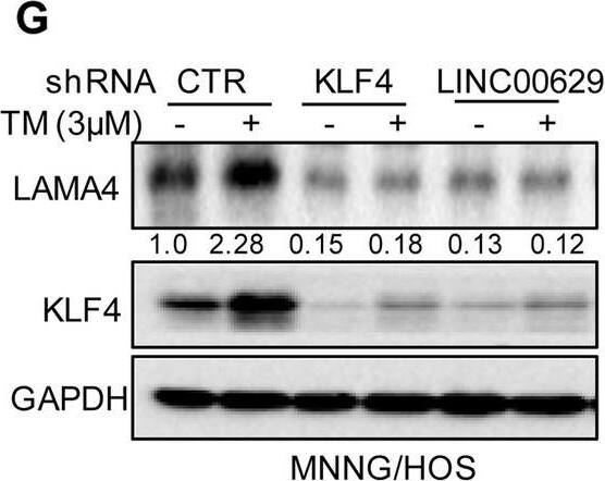 Detection of Laminin alpha 4 by Western Blot