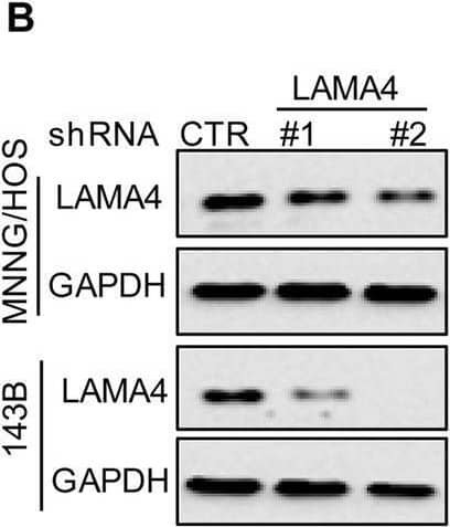 Detection of Laminin alpha 4 by Western Blot