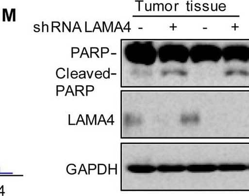 Detection of Laminin alpha 4 by Western Blot