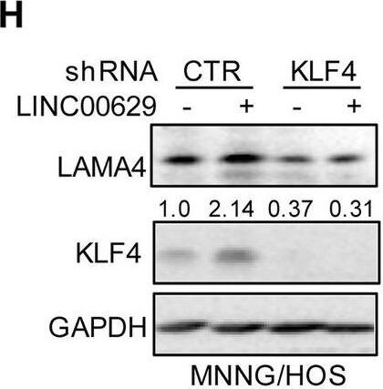 Detection of Laminin alpha 4 by Western Blot