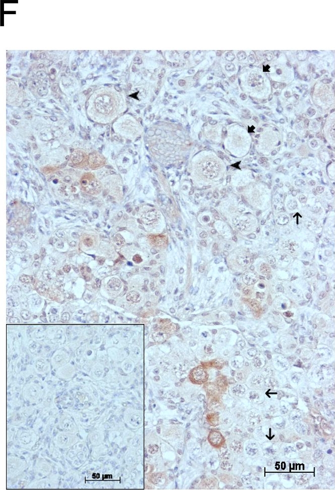 Detection of Human GDF-9 by Immunohistochemistry-Paraffin
