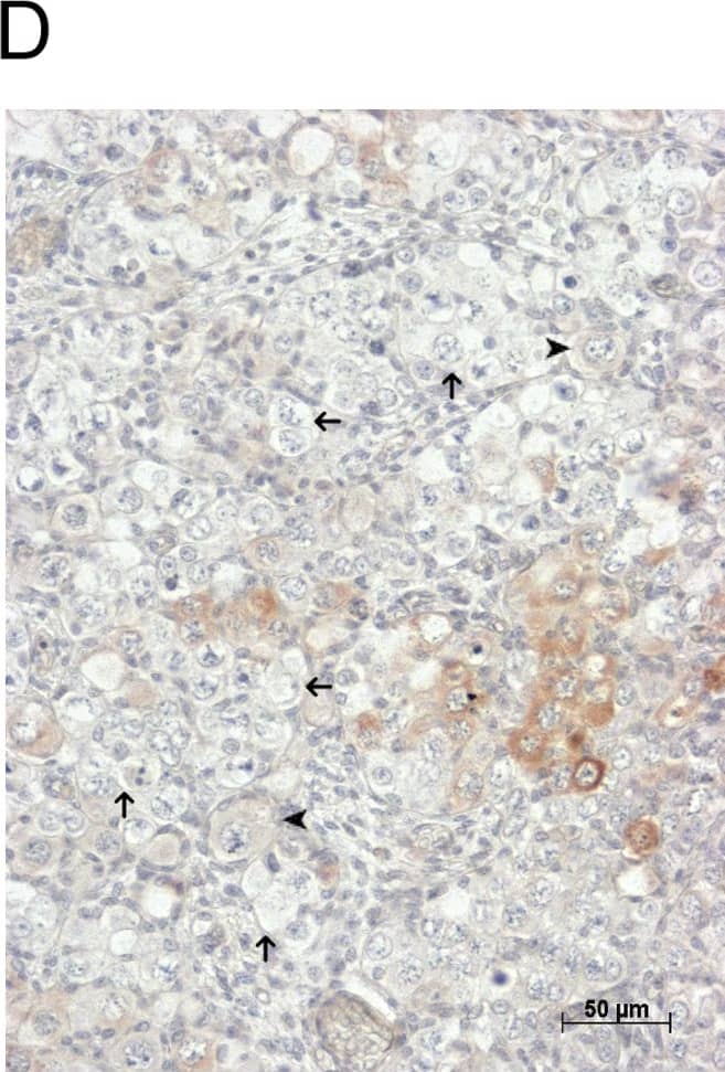 Detection of Human GDF-9 by Immunohistochemistry-Paraffin