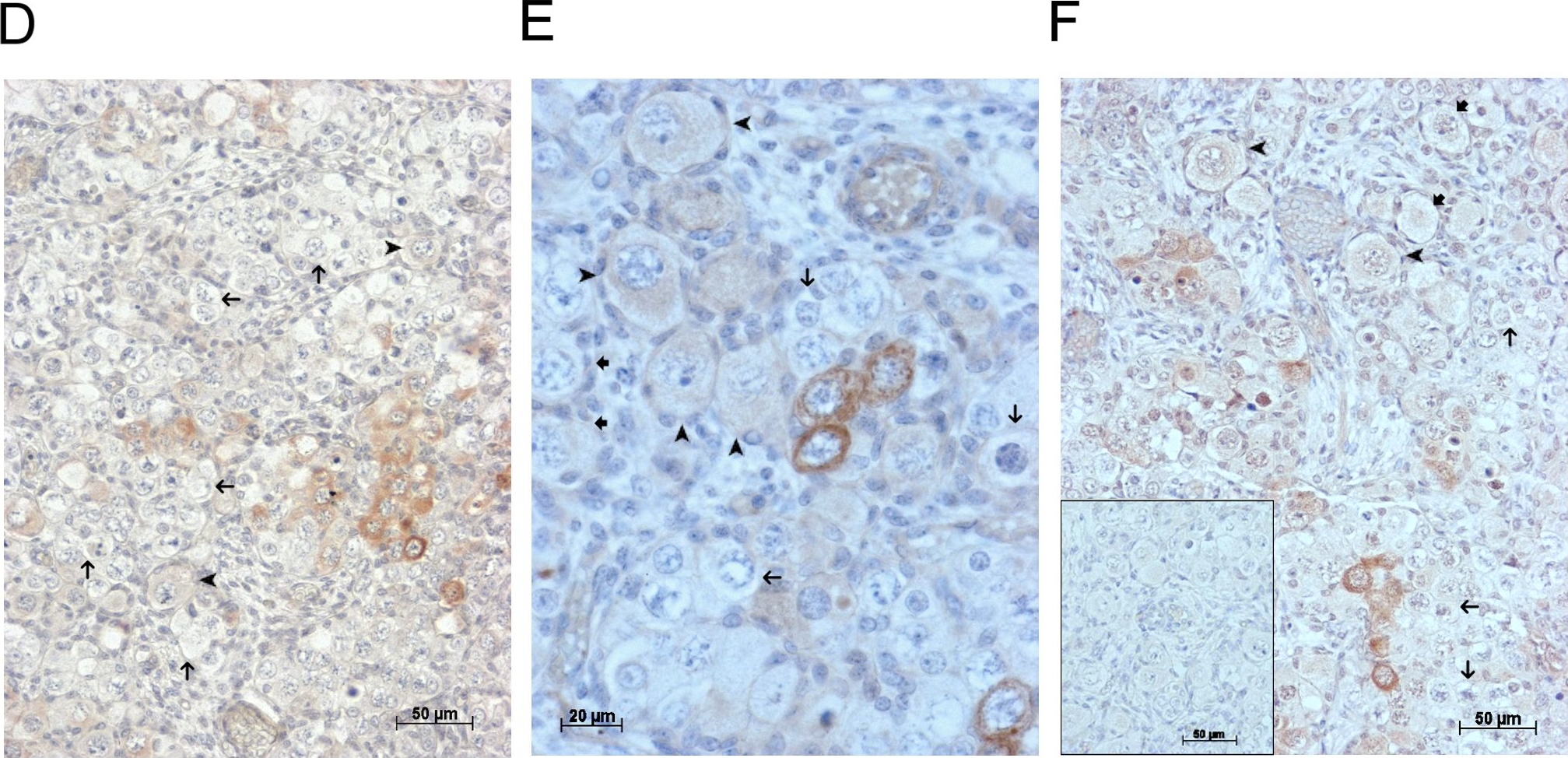 Detection of Human GDF-9 by Immunohistochemistry