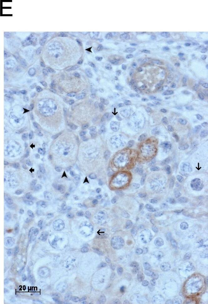 Detection of Human GDF-9 by Immunohistochemistry-Paraffin