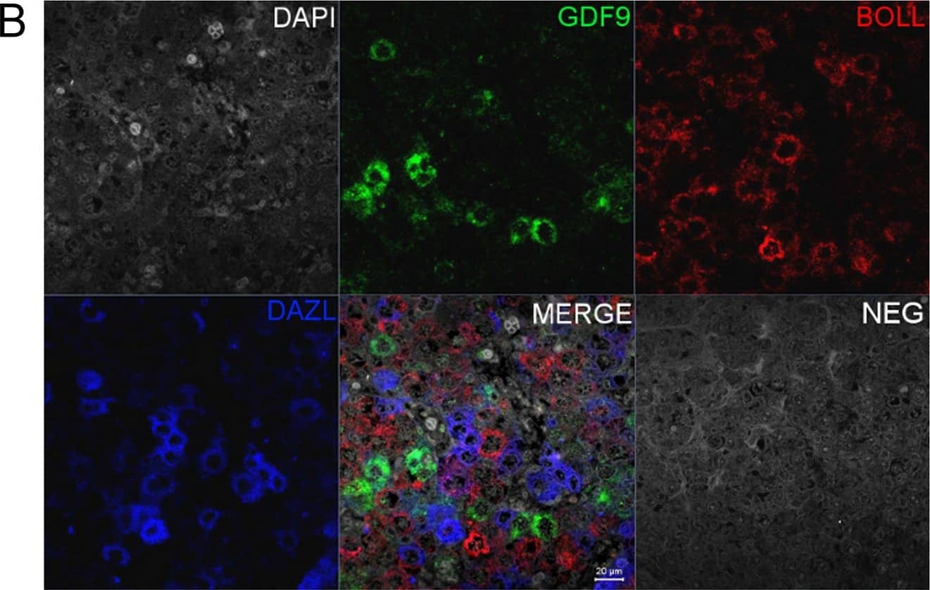 Detection of Human GDF-9 by Immunocytochemistry/ Immunofluorescence