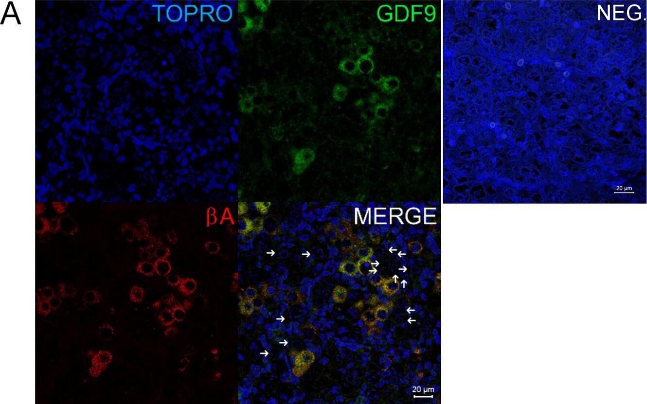 Detection of Human GDF-9 by Immunocytochemistry/ Immunofluorescence