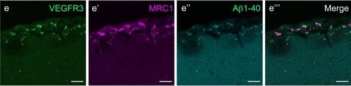 Detection of Mouse VEGFR3/Flt-4 by Immunocytochemistry/Immunofluorescence