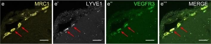Detection of Mouse VEGFR3/Flt-4 by Immunocytochemistry/Immunofluorescence