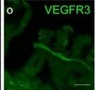Detection of Human VEGFR3/Flt-4 by Immunocytochemistry/Immunofluorescence