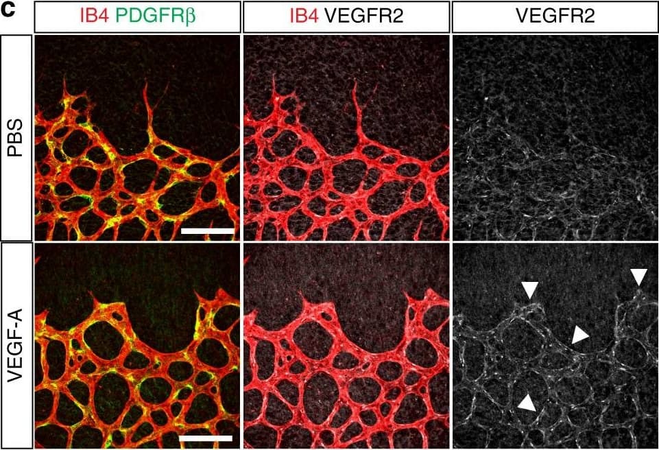 Detection of Mouse VEGFR3/Flt-4 by Immunohistochemistry