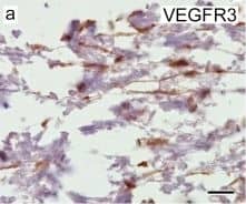 Detection of Human VEGFR3/Flt-4 by Immunocytochemistry/Immunofluorescence