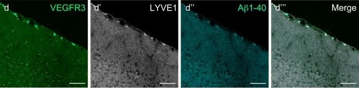 Detection of Mouse VEGFR3/Flt-4 by Immunocytochemistry/Immunofluorescence