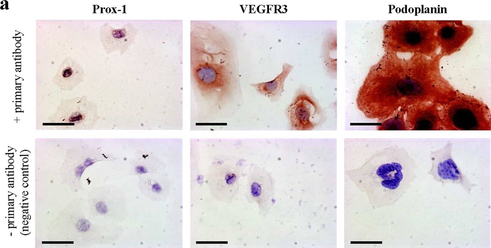 Detection of Mouse VEGFR3/Flt-4 by Immunohistochemistry