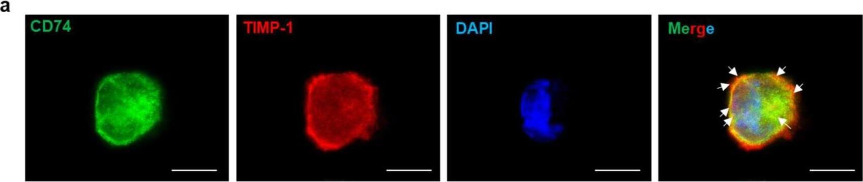 Detection of CD74 by Immunocytochemistry/ Immunofluorescence