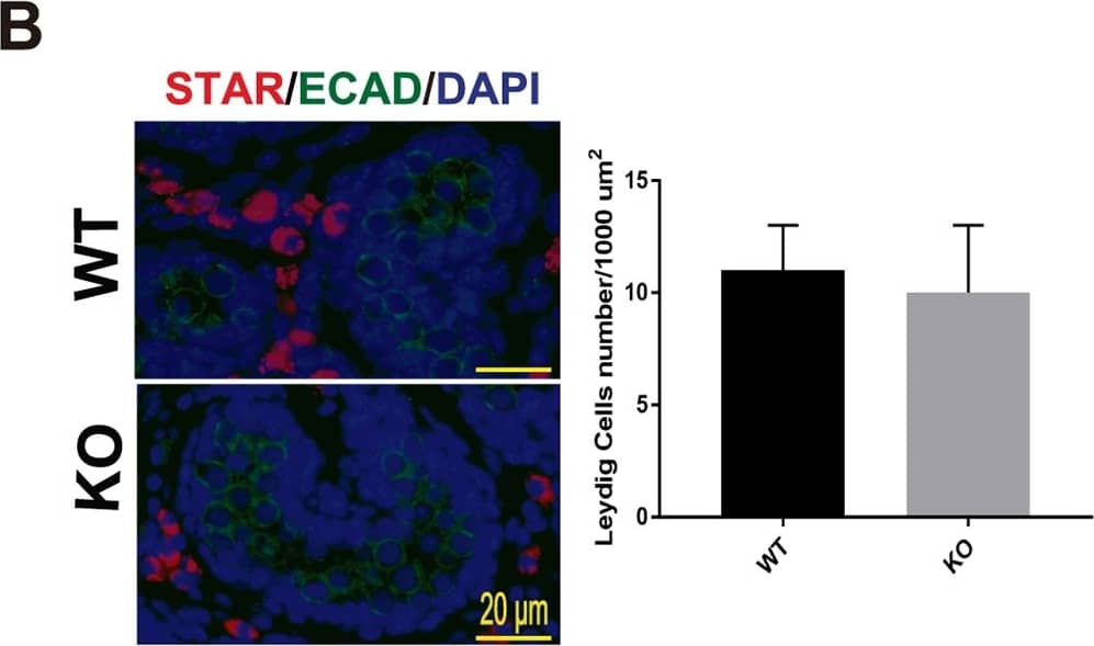 Detection of Mouse E-Cadherin by Immunocytochemistry/Immunofluorescence