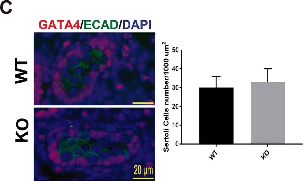 エリリンページ Burberry BE2347 EVELYN Prescription Eyeglasses | Free