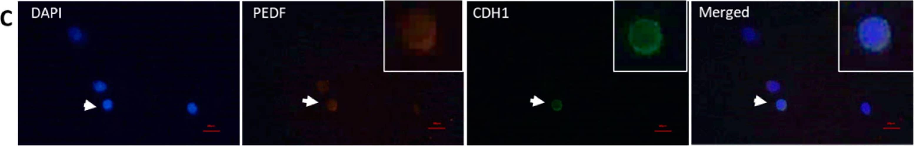 Detection of Mouse E-Cadherin by Immunocytochemistry/Immunofluorescence