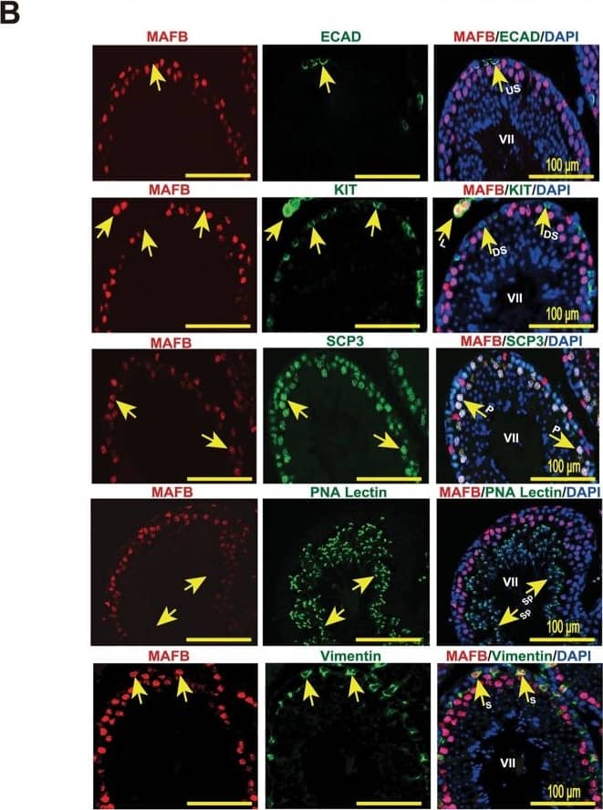 Detection of Mouse E-Cadherin by Immunocytochemistry/Immunofluorescence