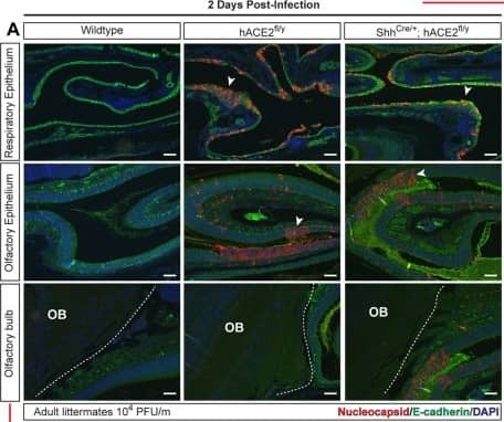 Detection of Mouse E-Cadherin by Immunohistochemistry-Paraffin