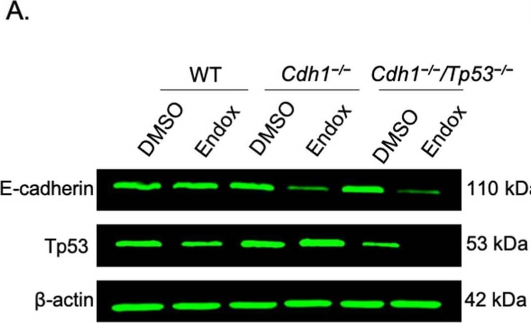 Detection of E-Cadherin by Western Blot