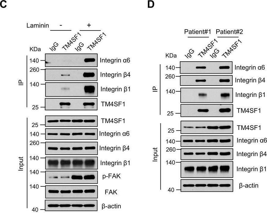 Detection of Human TM4SF1 by Western Blot
