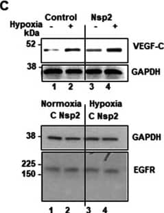 Detection of Human VEGF-C by Western Blot