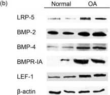 Detection of BMP-4 by Western Blot