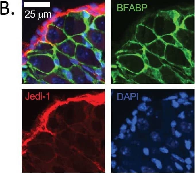 Detection of Mouse PEAR1 by Immunohistochemistry