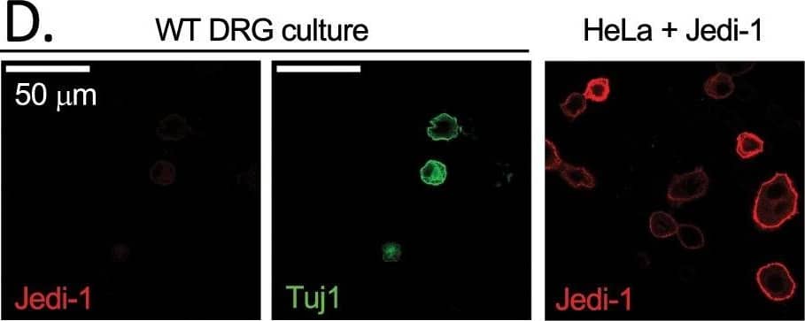 Detection of Mouse PEAR1 by Immunocytochemistry/Immunofluorescence