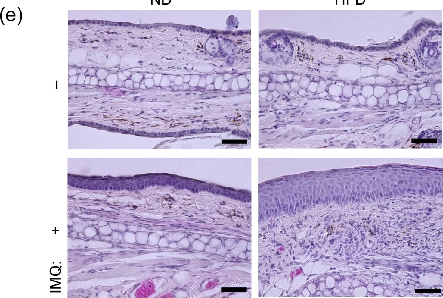 Detection of Mouse CCL20/MIP-3 alpha by Immunohistochemistry