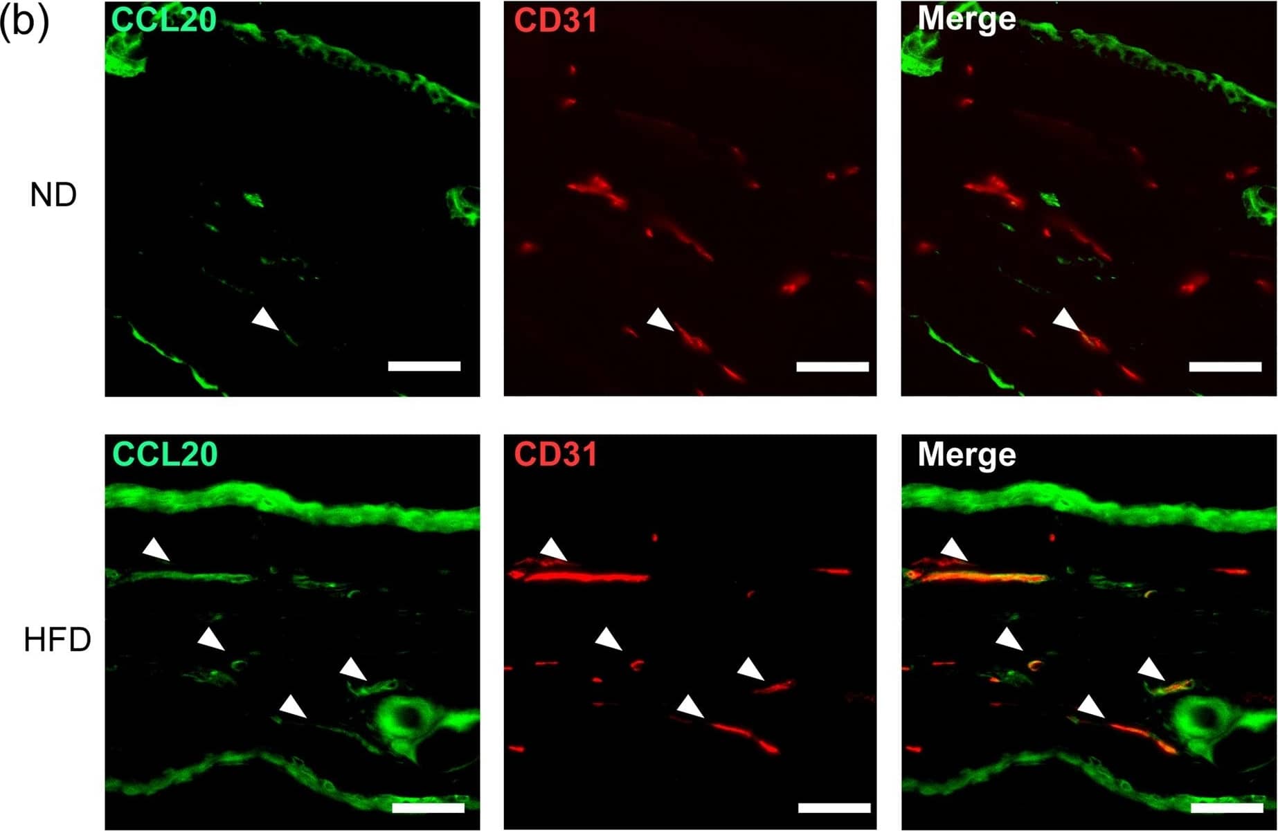 Detection of Mouse CCL20/MIP-3 alpha by Immunohistochemistry