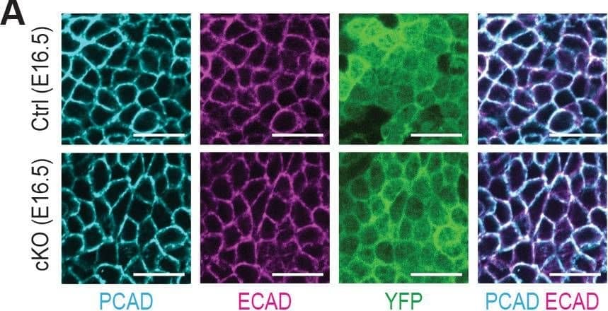 Detection of Mouse P-Cadherin by Immunohistochemistry