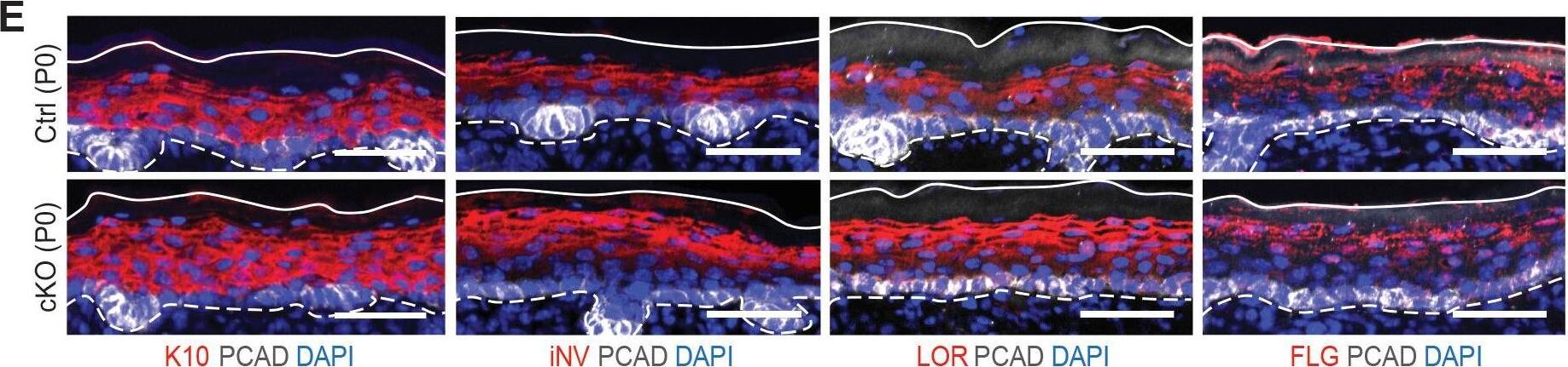 Detection of Mouse P-Cadherin by Immunohistochemistry