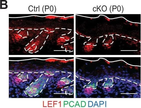 Detection of Mouse P-Cadherin by Immunohistochemistry