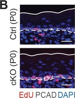 Detection of Mouse P-Cadherin by Immunohistochemistry