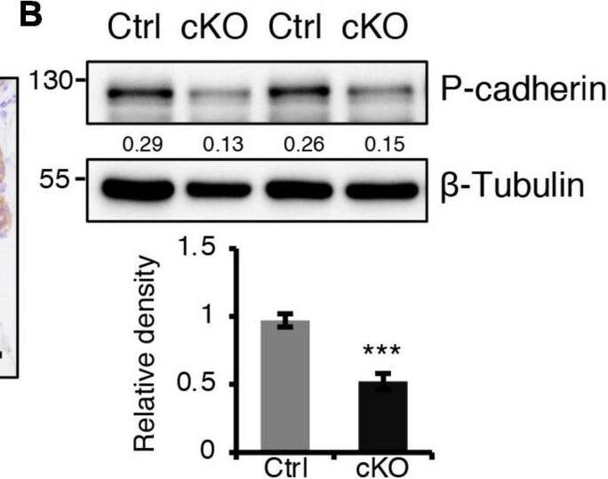 Detection of Mouse P-Cadherin by Western Blot