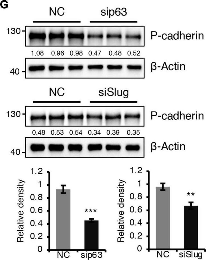 Detection of Mouse P-Cadherin by Western Blot