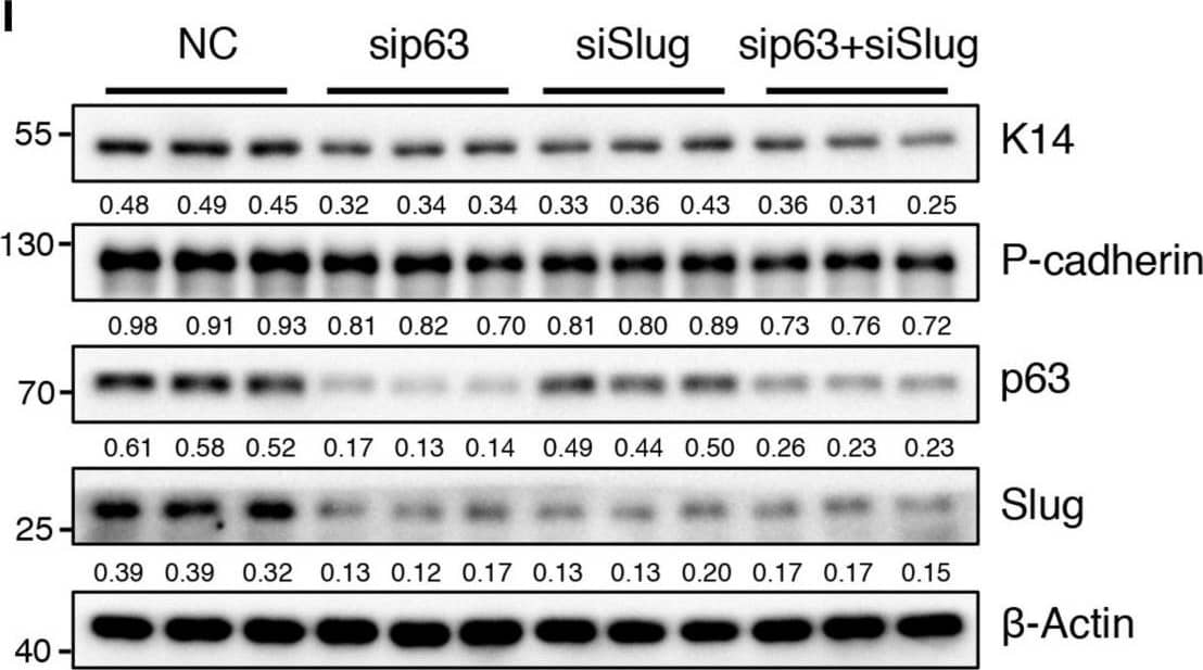 Detection of Mouse P-Cadherin by Western Blot