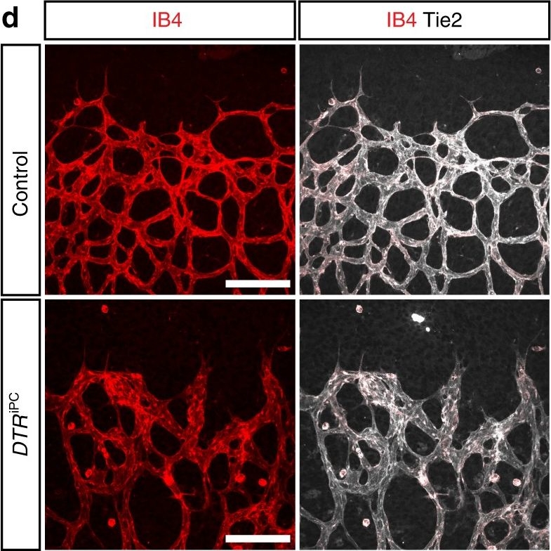 Detection of Mouse Tie-2 by Immunocytochemistry/ Immunofluorescence