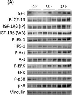 Detection of Mouse IGF-I/IGF-1 by Western Blot