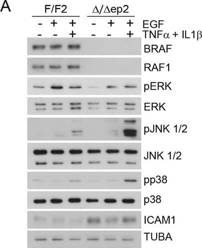 Detection of Mouse ICAM-1/CD54 by Western Blot