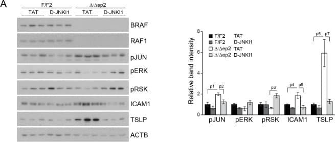 Detection of Mouse ICAM-1/CD54 by Western Blot