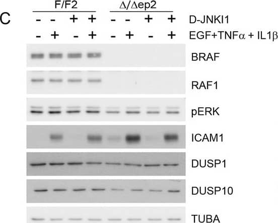 Detection of Mouse ICAM-1/CD54 by Western Blot