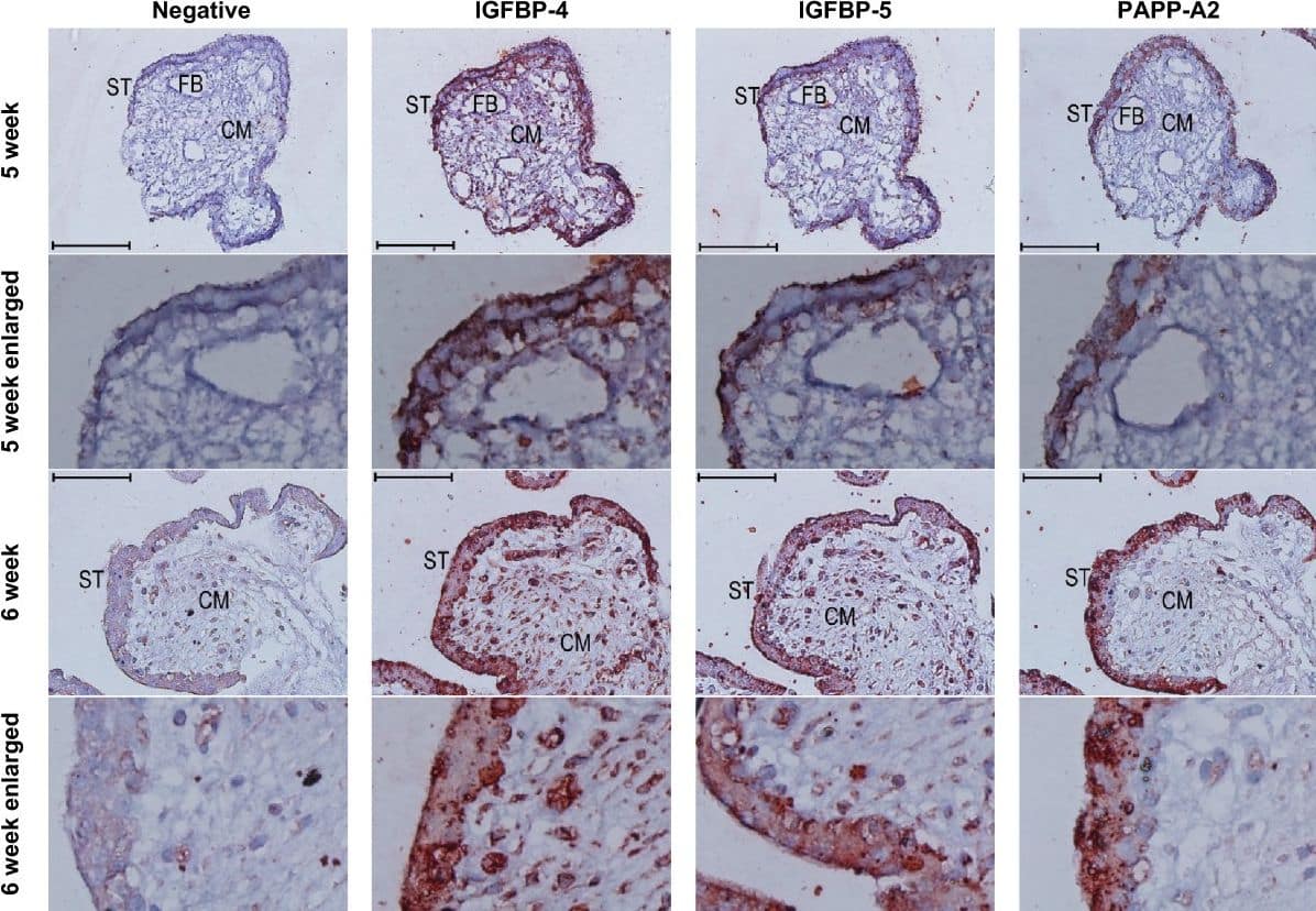 Detection of Human IGFBP-4 by Immunohistochemistry